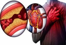 Heart Blockage Signs