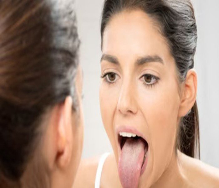 Vitamin-B12 Deficiency