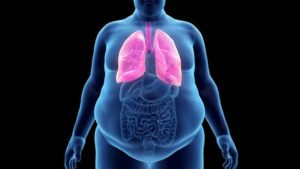 Health risks of obesity