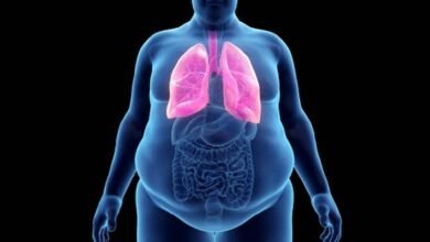 Health risks of obesity