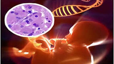 Lysosomal Storage Disorder India