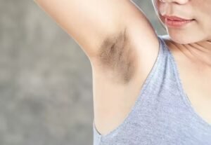 Alum Benefits for Dark Underarms