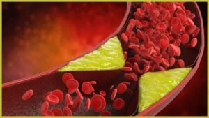 Natural Cholesterol Control Methods