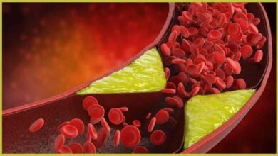 Natural Cholesterol Control Methods