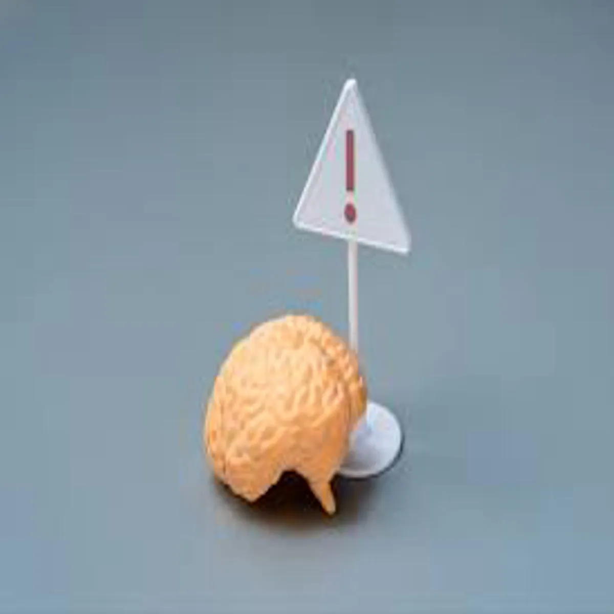 Alzheimerrisk Alzheimerrisk Bdhte Mamlon Bich Samne