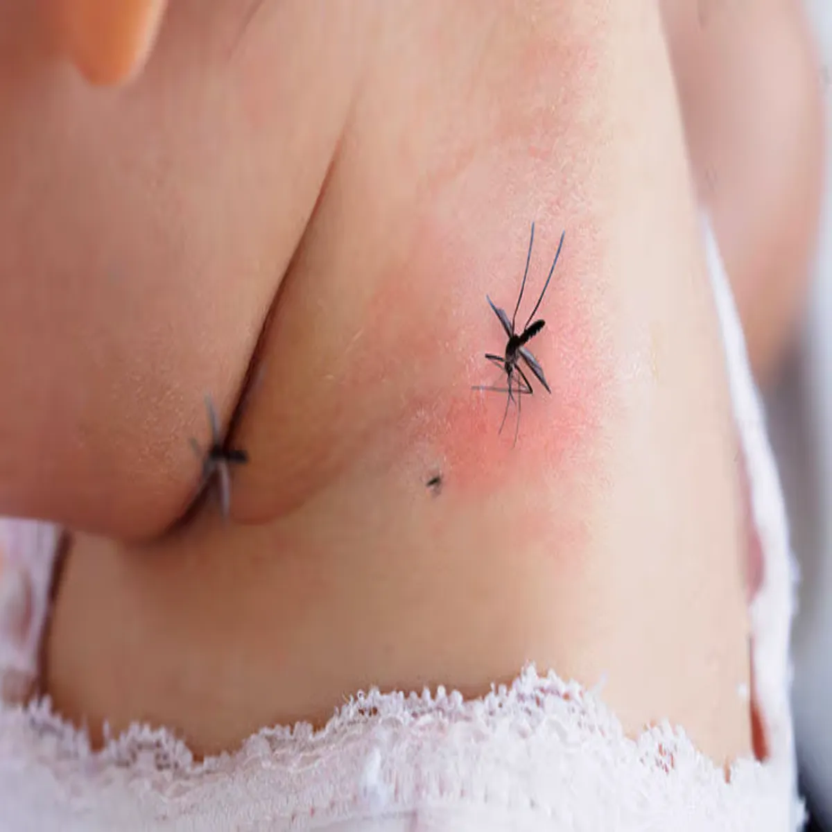 Malariasymptoms Malariasymptoms Grmiyon Men Mleriya Khtra