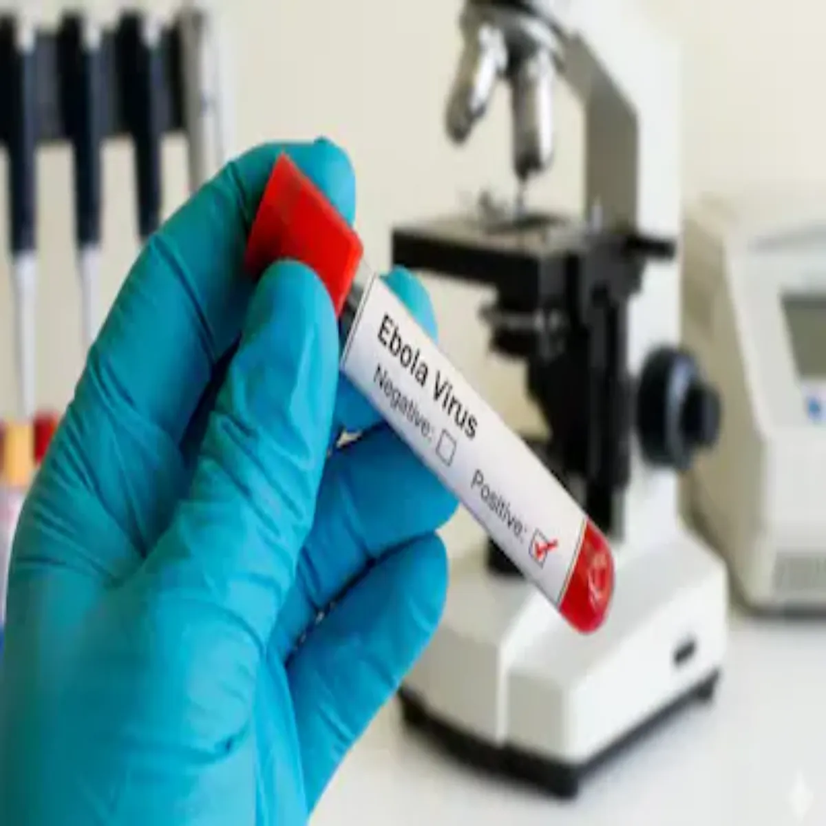 Ebolavirus Ebolavirus Ibola Snkrm Lekr Kendr