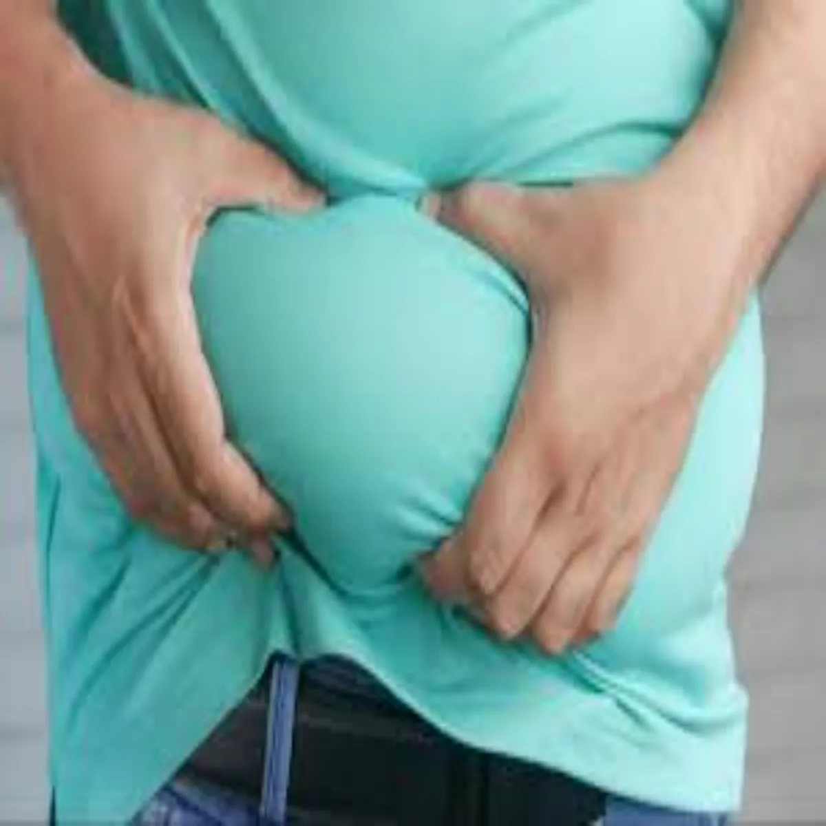 Obesityrisk Obesityrisk Motapa Bdha Skta Kee