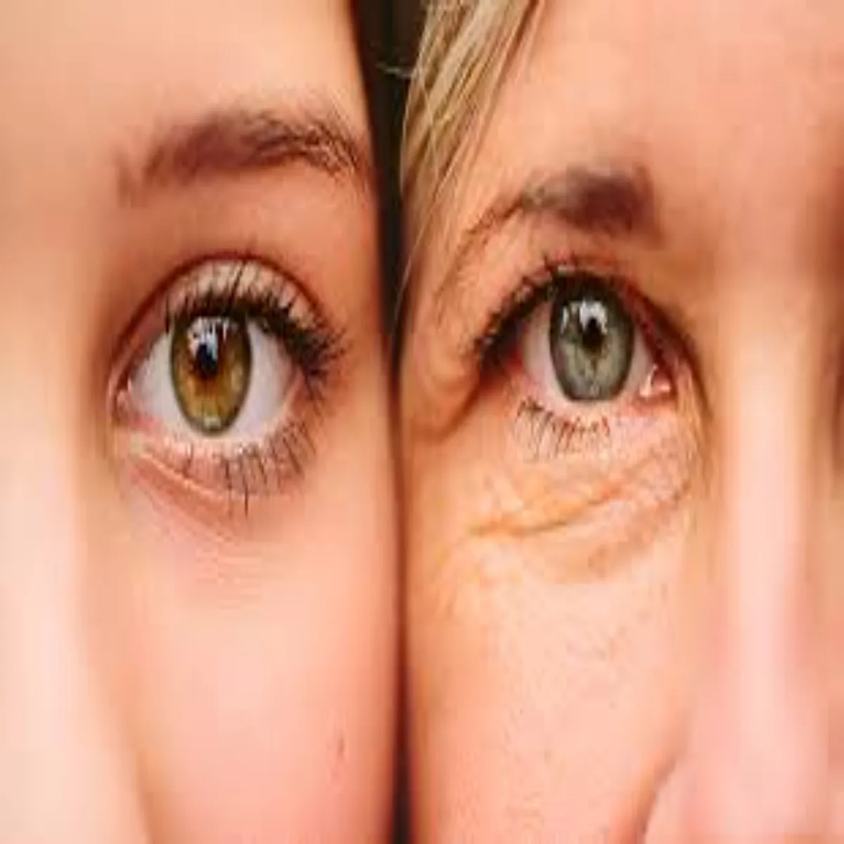Eye Health Eye Health Aankhon Men