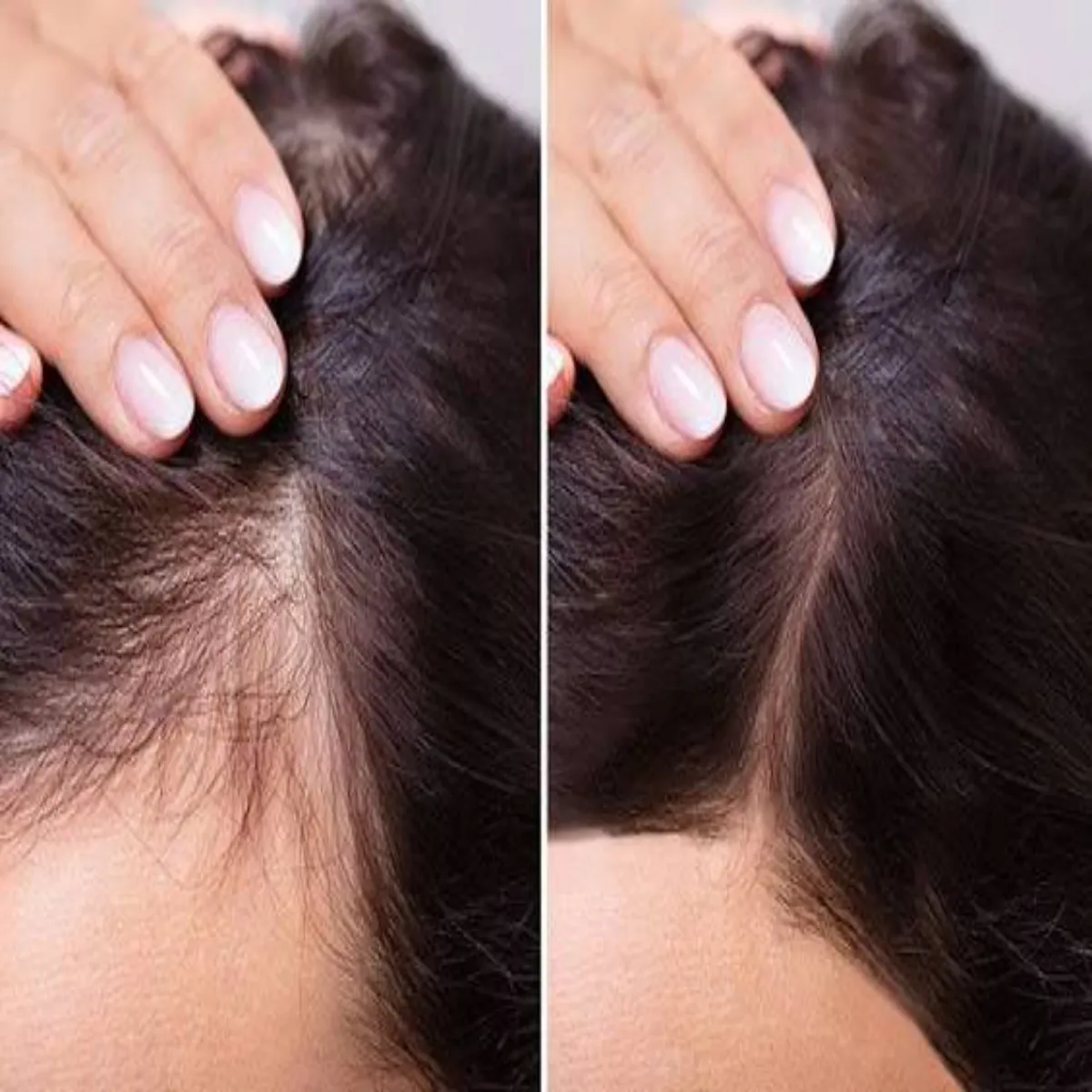 Hairfall Hairfall Phtapht Janen Mhnge Heyr