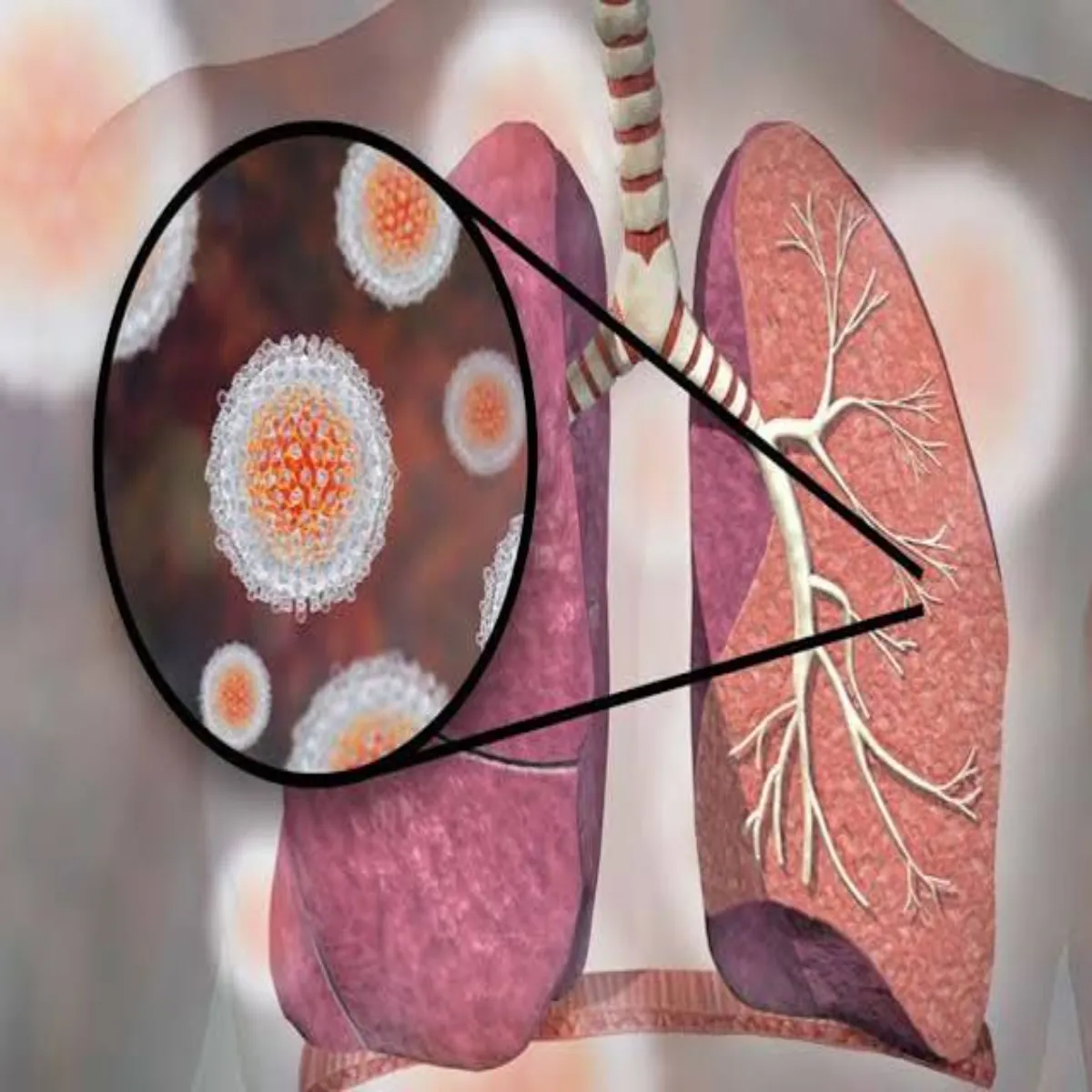Liverhealth Liverhealth Hepetaitis Jokhim Men Liverhealth