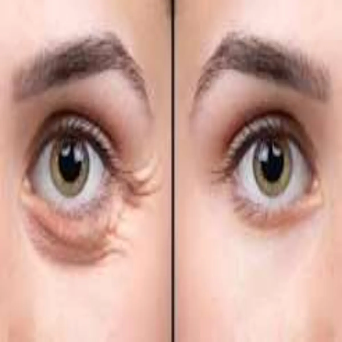 Skincare Skincare Umr Men Bdh Rhin