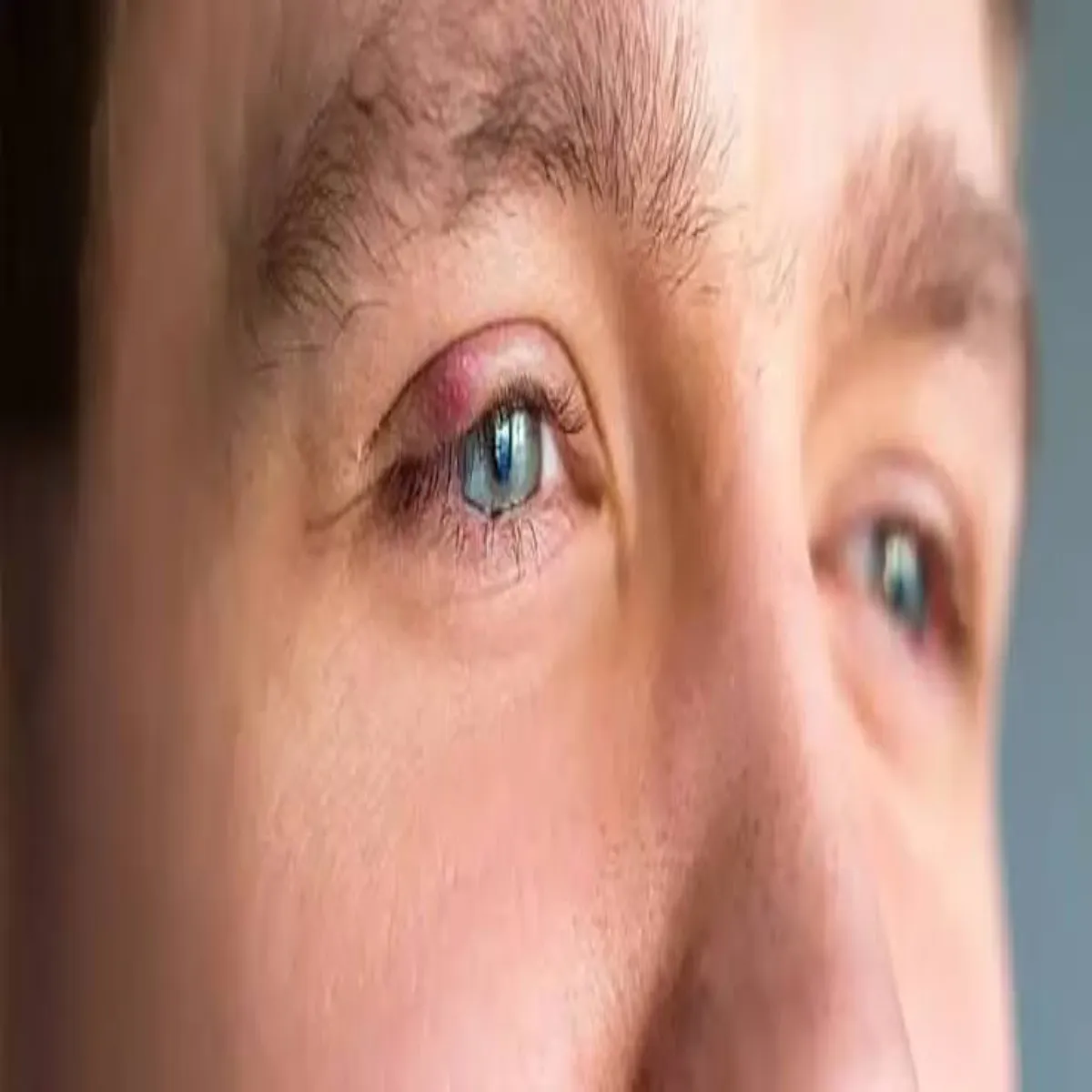 Eyehealth Eyehealth Aankh Phdkne Pichhe Kya